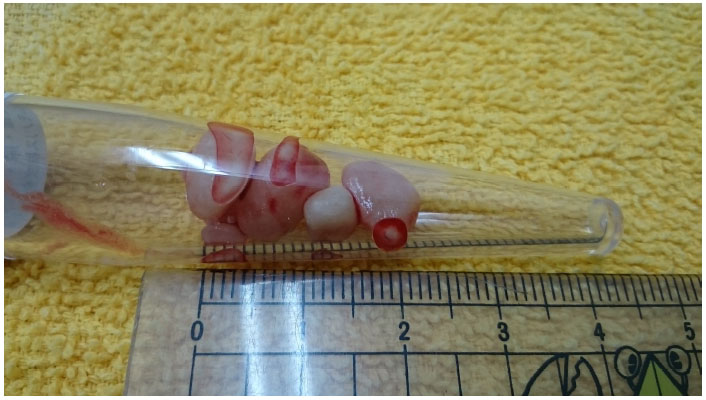 葛飾区の動物病院 膀胱結石摘出手術